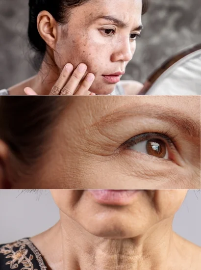 Choosing a Cream for India’s Surroundings