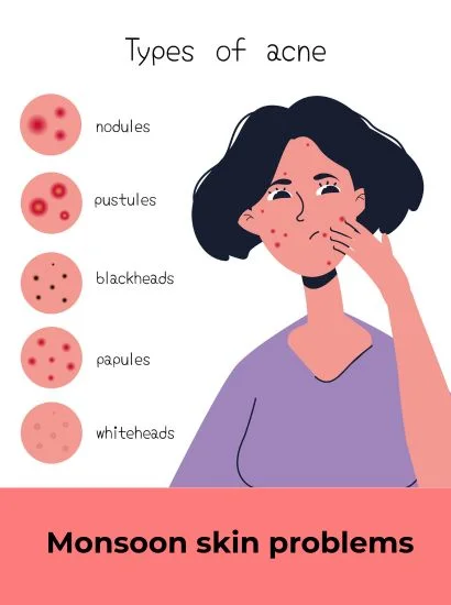 mansoon skin problem